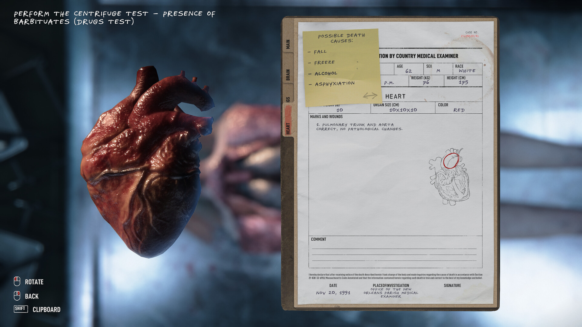Autopsy Simulator в Steam с выгодной скидкой 66 % — купить за ~$6.65 до 26 января